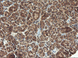 MAOA Antibody in Immunohistochemistry (Paraffin) (IHC (P))
