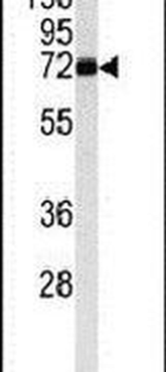 Monoamine Oxidase B Antibody in Western Blot (WB)