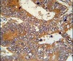 MAP1S Antibody in Immunohistochemistry (IHC)