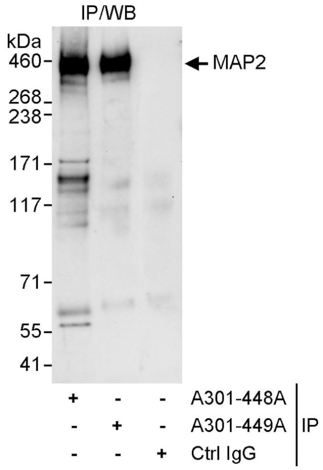 MAP2 Antibody in Immunoprecipitation (IP)