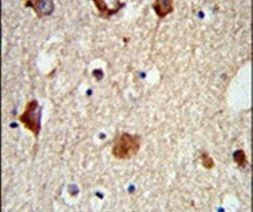MAP2 Antibody in Immunohistochemistry (IHC)