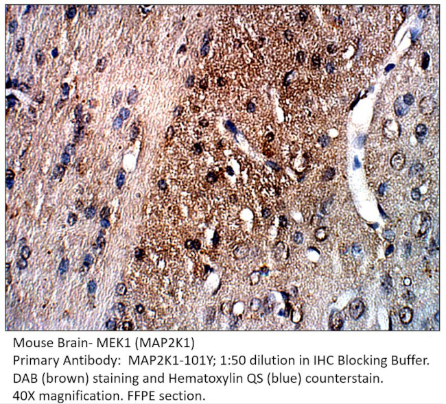 MAP2K1 Antibody in Immunohistochemistry (IHC)