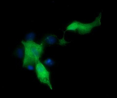MAP2K1 Antibody in Immunocytochemistry (ICC/IF)
