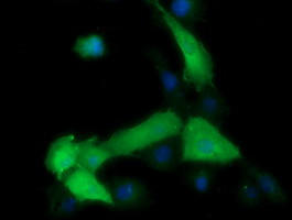 MAP2K1 Antibody in Immunocytochemistry (ICC/IF)