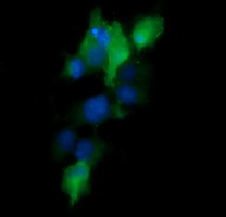 MAP2K1 Antibody in Immunocytochemistry (ICC/IF)