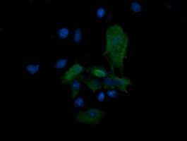 MAP2K3 Antibody in Immunocytochemistry (ICC/IF)
