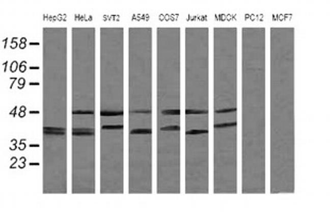 MAP2K3 Antibody in Western Blot (WB)