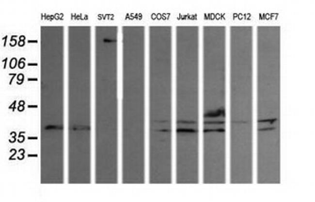 MAP2K3 Antibody in Western Blot (WB)