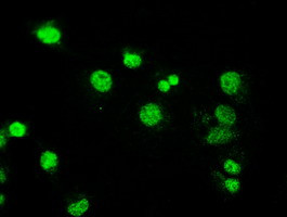 MAP2K4 Antibody in Immunocytochemistry (ICC/IF)