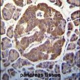 LZK Antibody in Immunohistochemistry (IHC)