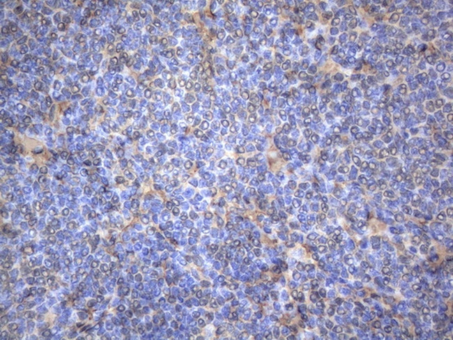 MAP3K8 Antibody in Immunohistochemistry (Paraffin) (IHC (P))