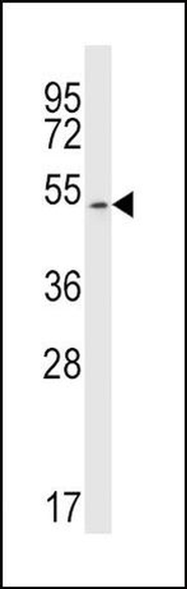 JNK3 Antibody in Western Blot (WB)