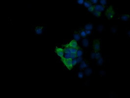 MAPK13 Antibody in Immunocytochemistry (ICC/IF)
