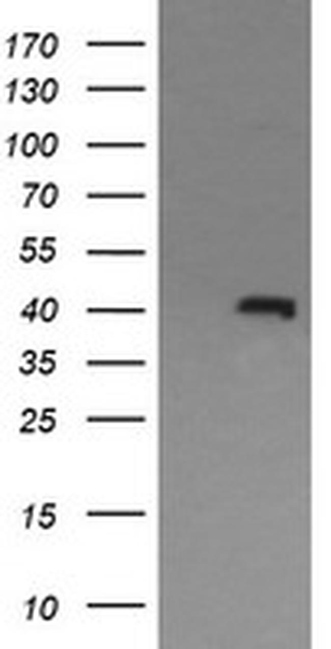 MAPK13 Antibody in Western Blot (WB)