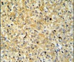 MAPK1IP1L Antibody in Immunohistochemistry (IHC)