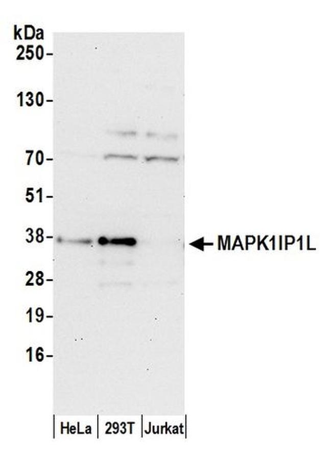 MAPK1IP1L Antibody in Western Blot (WB)