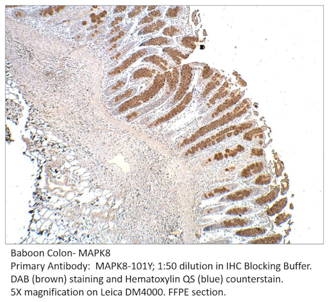 MAPK8 Antibody in Immunohistochemistry (IHC)