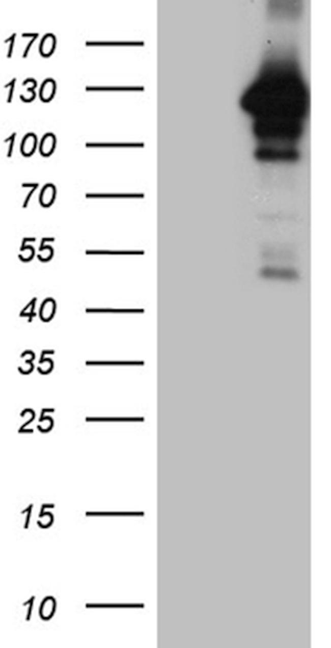 MAPK8IP1 Antibody in Western Blot (WB)