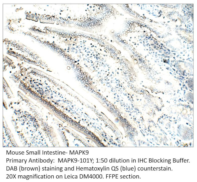 MAPK9 Antibody in Immunohistochemistry (IHC)