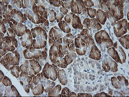 MAPK9 Antibody in Immunohistochemistry (Paraffin) (IHC (P))