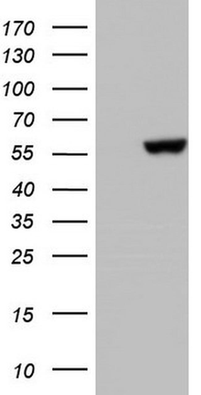 MAPKAPK5 Antibody in Western Blot (WB)