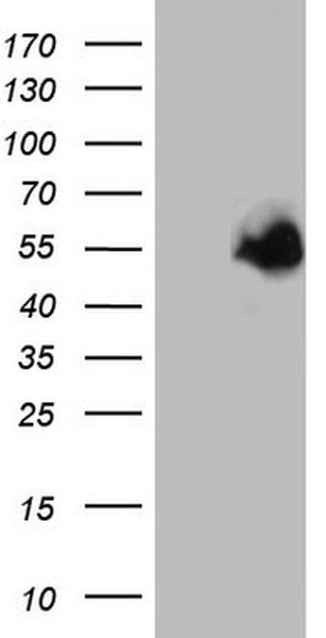 MAPKAPK5 Antibody in Western Blot (WB)