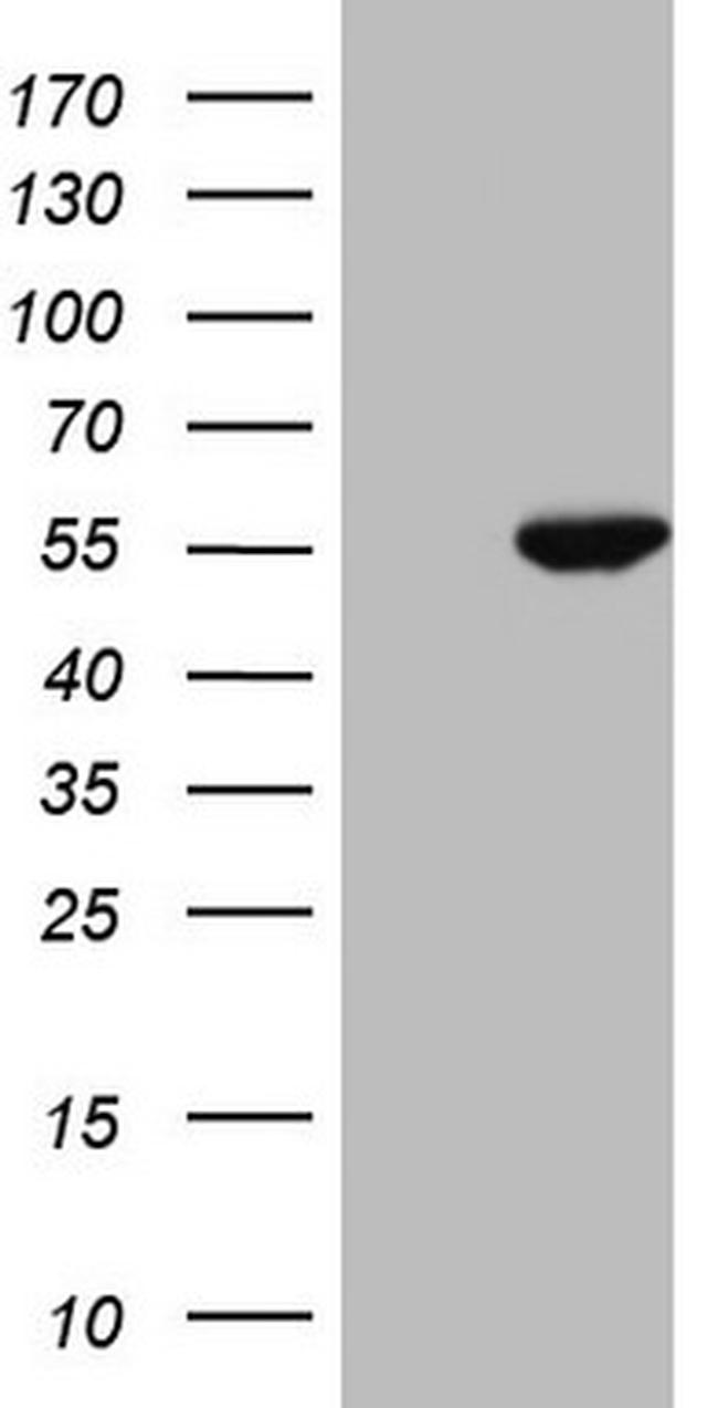MAPKAPK5 Antibody in Western Blot (WB)