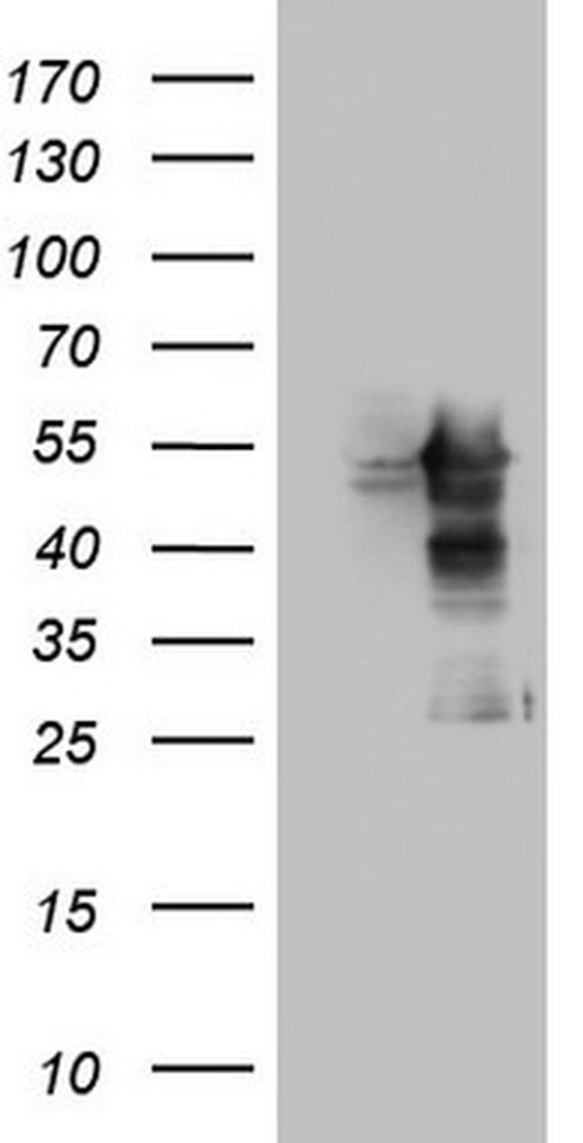MAPKAPK5 Antibody in Western Blot (WB)
