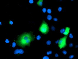 EB2 (MAPRE2) Antibody in Immunocytochemistry (ICC/IF)