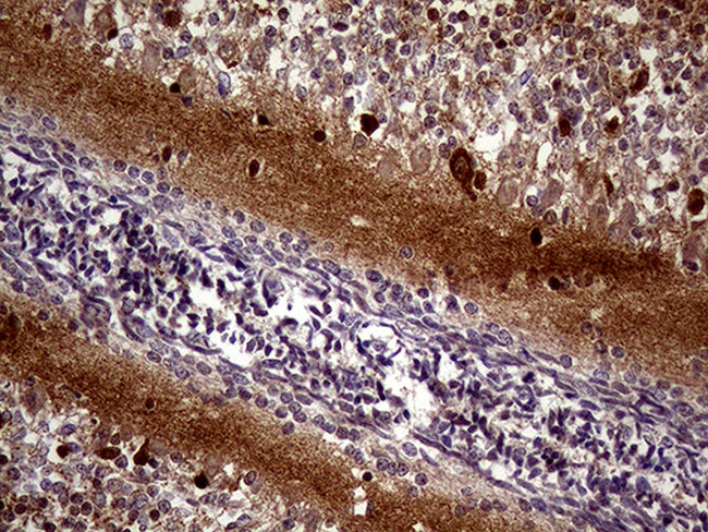 MAPT Antibody in Immunohistochemistry (Paraffin) (IHC (P))