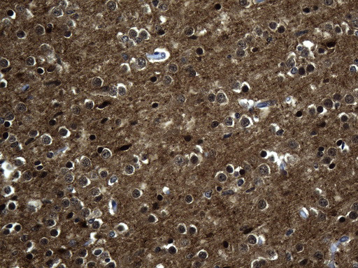 MAPT Antibody in Immunohistochemistry (Paraffin) (IHC (P))
