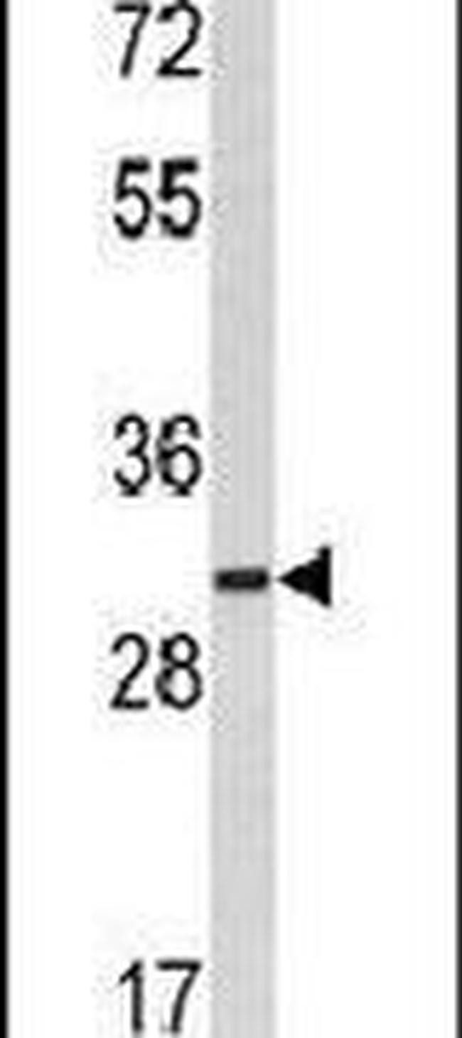 MARCKS Antibody in Western Blot (WB)