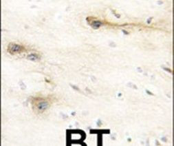 MARK1 Antibody in Immunohistochemistry (IHC)