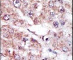 MARK2 Antibody in Immunohistochemistry (IHC)