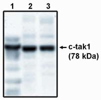 TAK1 Antibody in Western Blot (WB)