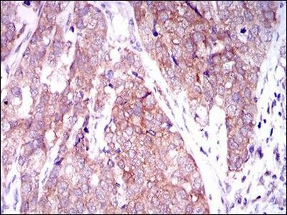 MARK3 Antibody in Immunohistochemistry (Paraffin) (IHC (P))