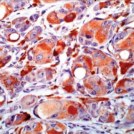 Melan-A Antibody in Immunohistochemistry (IHC)