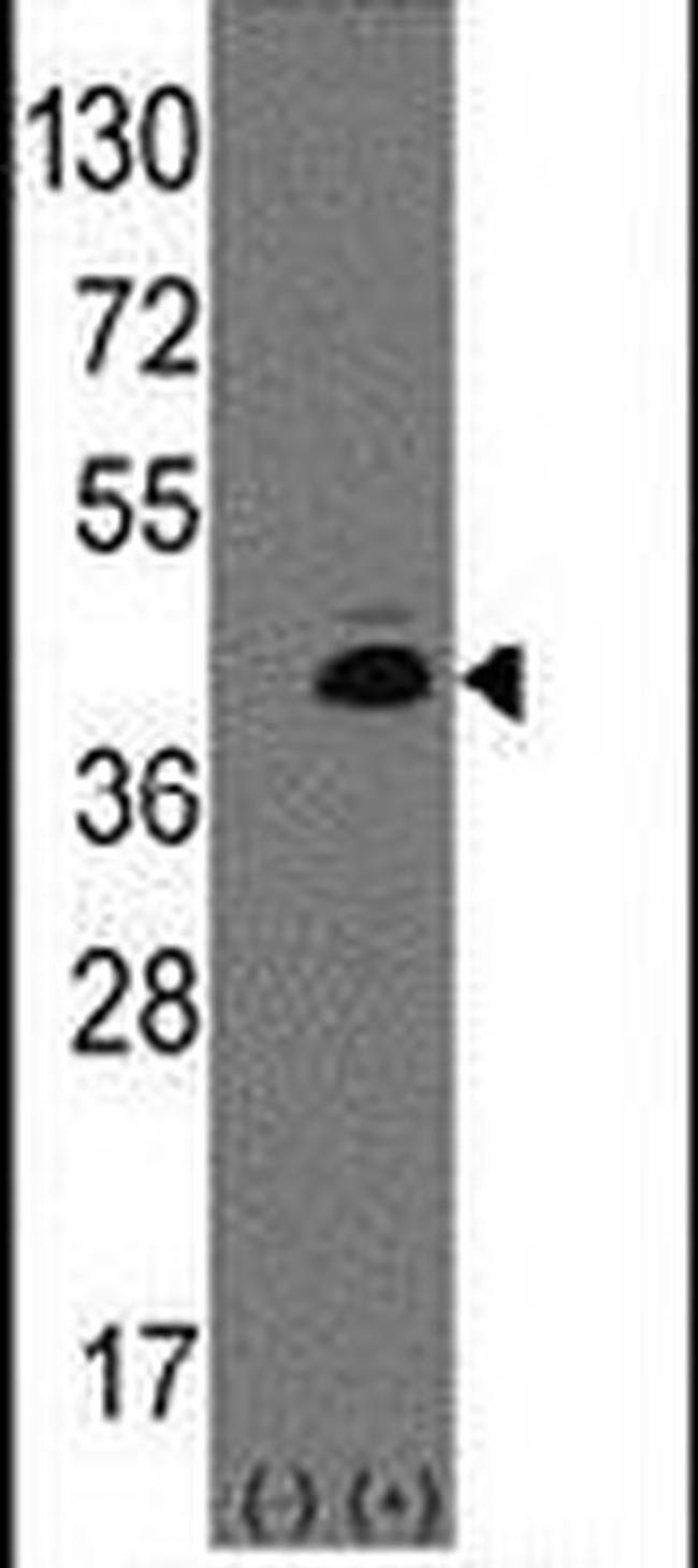 ATOH1 Antibody in Western Blot (WB)