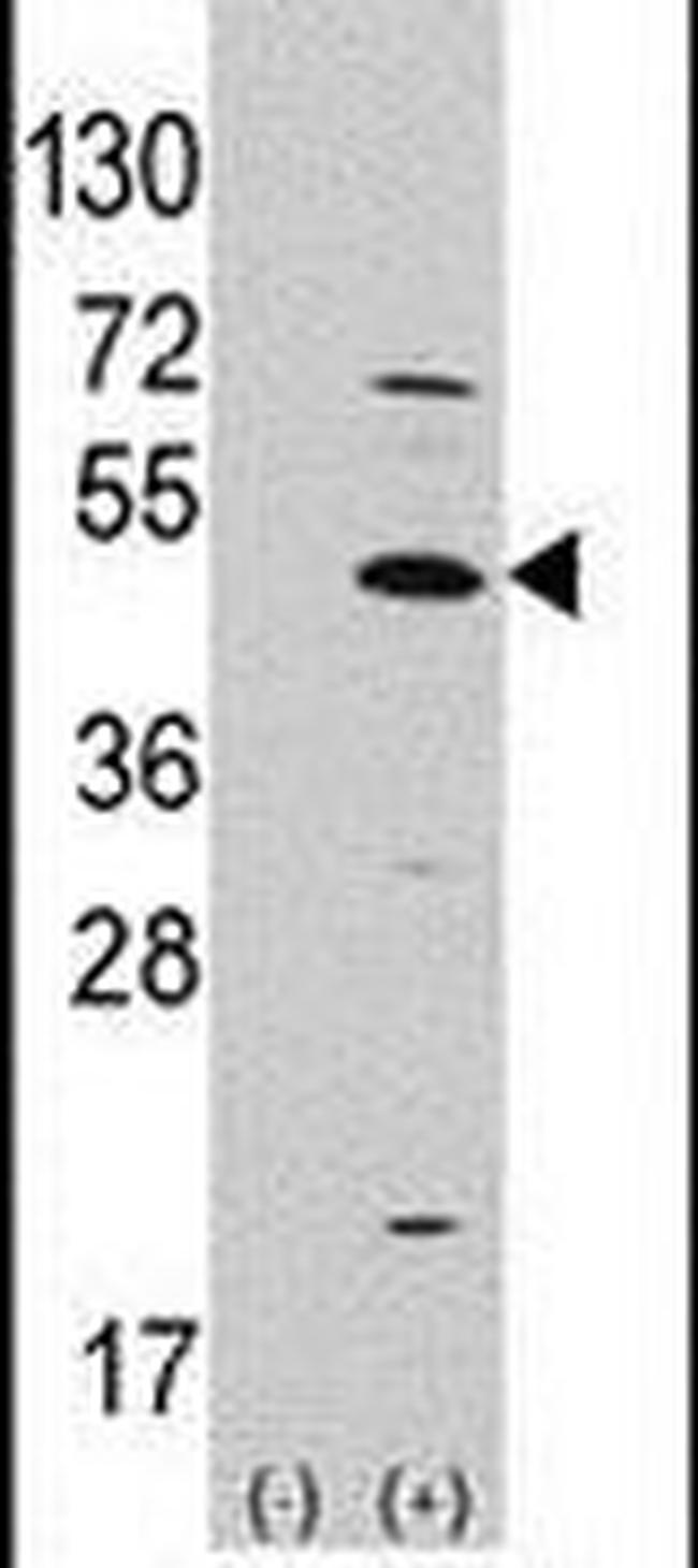 ATOH1 Antibody in Western Blot (WB)