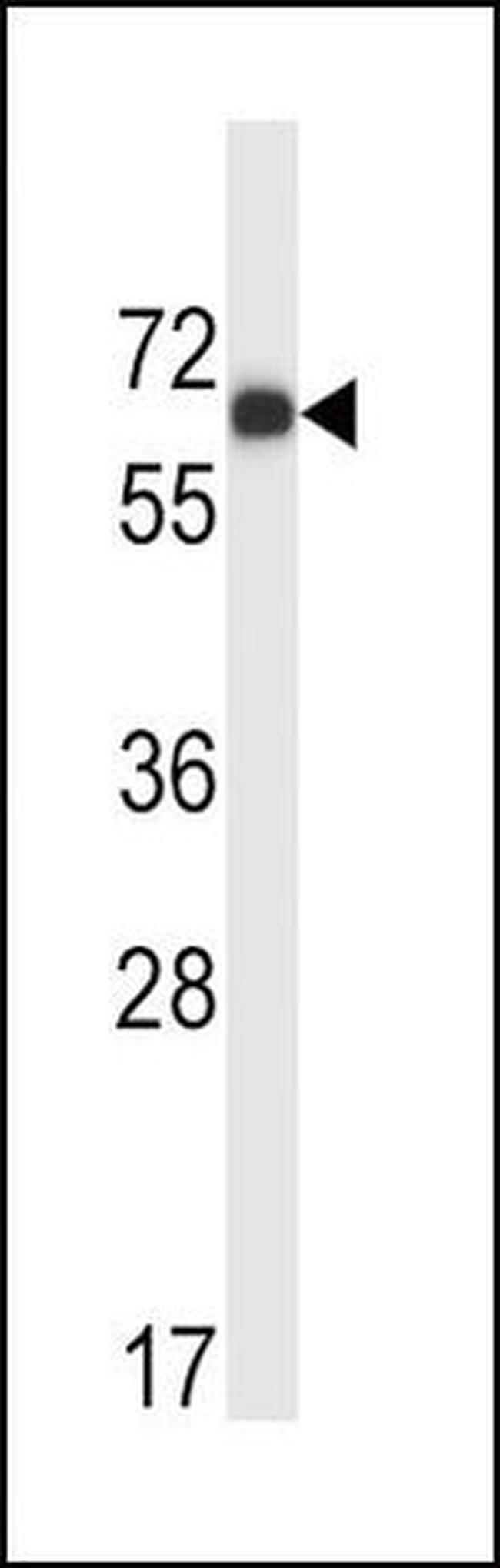 MATK Antibody in Western Blot (WB)
