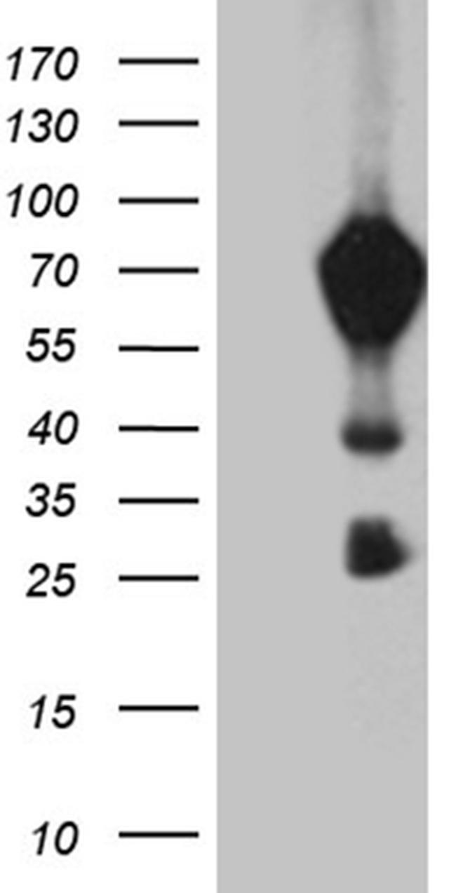 MBD1 Antibody in Western Blot (WB)