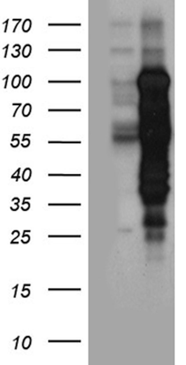 MBD1 Antibody in Western Blot (WB)