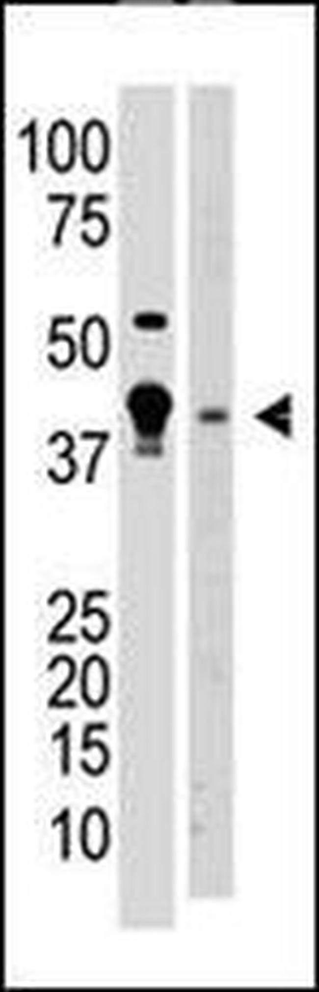 MBD2 Antibody in Western Blot (WB)