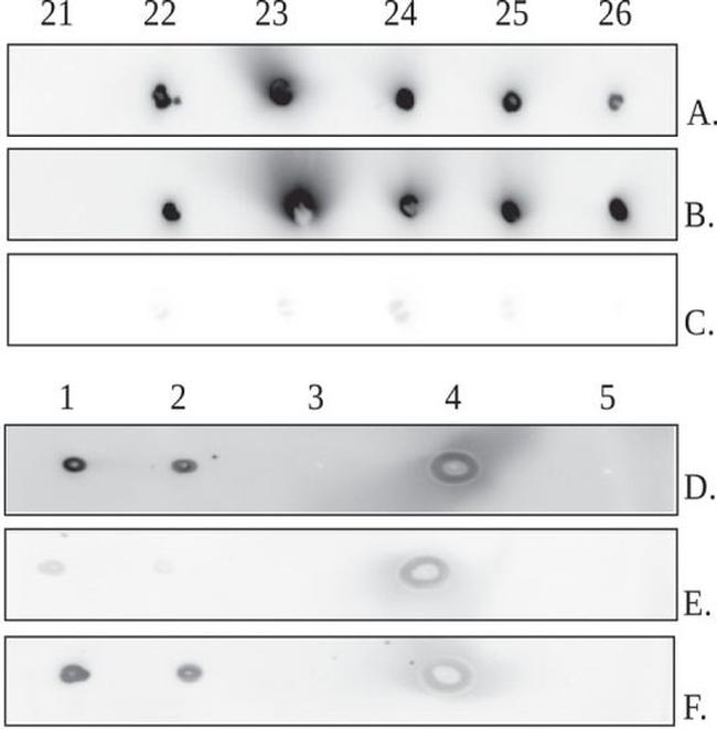 MBL2 Antibody in Dot Blot (DB)
