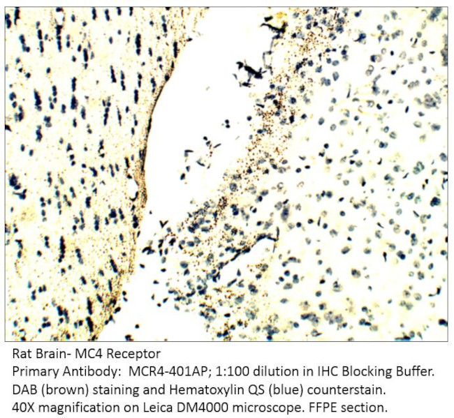 MC4 Receptor Antibody in Immunohistochemistry (IHC)