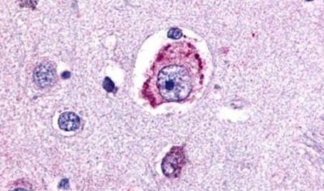 MC4R Antibody in Immunohistochemistry (Paraffin) (IHC (P))