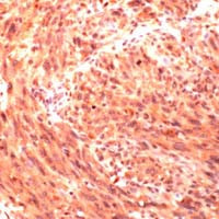 CD146 Antibody in Immunohistochemistry (IHC)