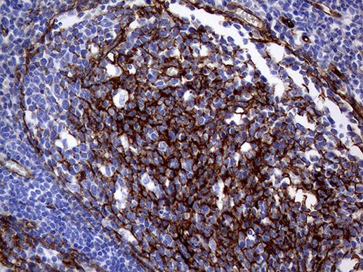 MCAM Antibody in Immunohistochemistry (Paraffin) (IHC (P))
