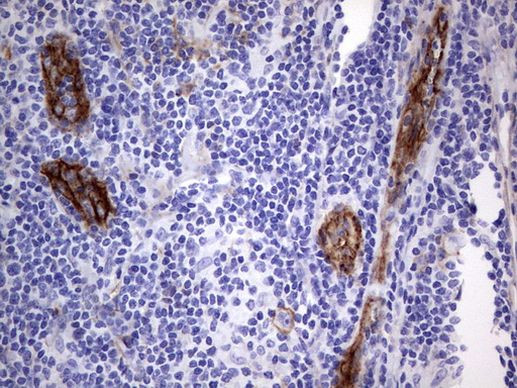 MCAM Antibody in Immunohistochemistry (Paraffin) (IHC (P))