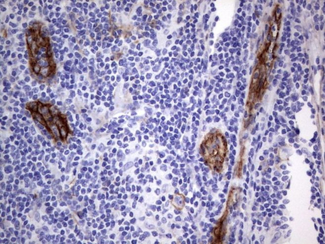 MCAM Antibody in Immunohistochemistry (Paraffin) (IHC (P))